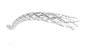 stent 11 .136 - Copy.png